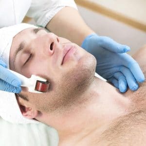 derma roller for beard